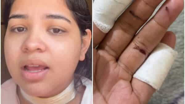 ‘I was struggling for my life’: Kite ‘manjha’ injures Pune woman ahead of Makar Sankranti, viral video sparks debate | Today News