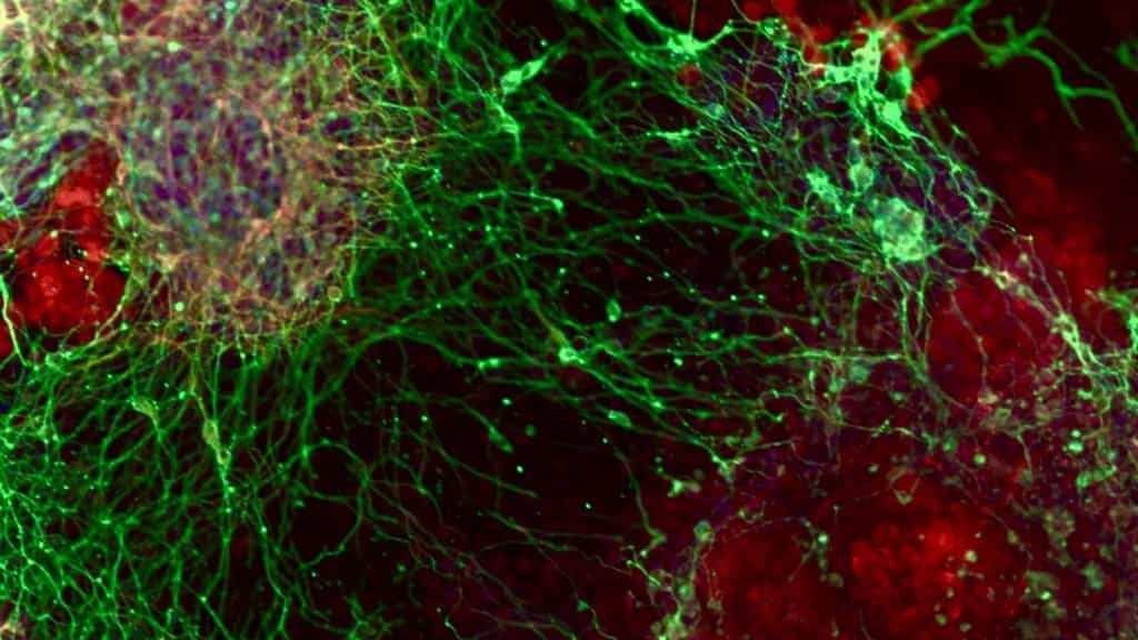 A massive gene hunt reveals how brain cells are made